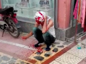Kardeş davulcuların yer kavgası kanlı bitti