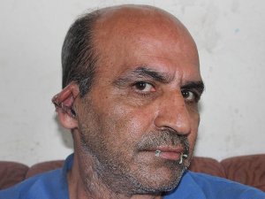 İranlı sığınmacı protesto için ağzını ve kulaklarını dikti