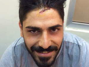 Trabzonsporlu futbolcu İbrahim Demir, trafik kazası geçirdi