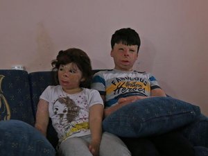 Suriyeli kardeşler ellerine kavuşmak istiyor