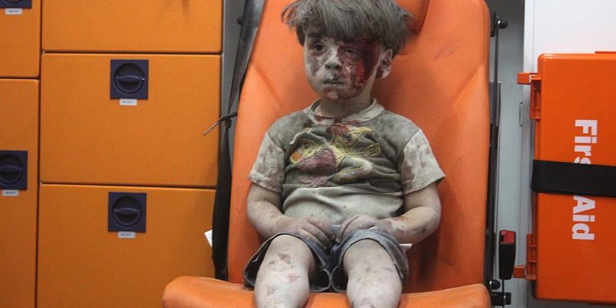 Halep'li 5 yaşındaki ''Ümran Daknes''in dramı herkesi etkiledi