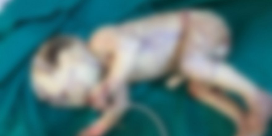 Siirt’te dünyaya geldi: Milyonda bir kez görülüyor