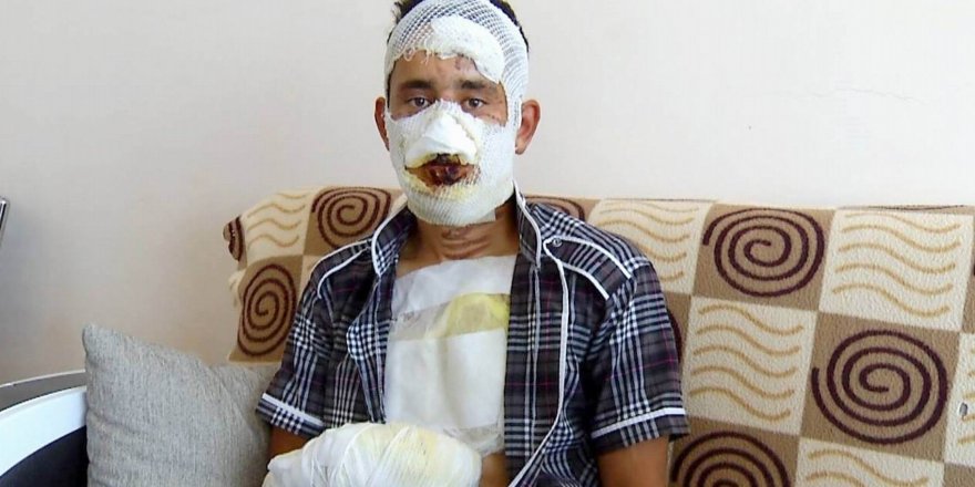Şok iddia! Konya'da askerin üzerine kolonya döküp...