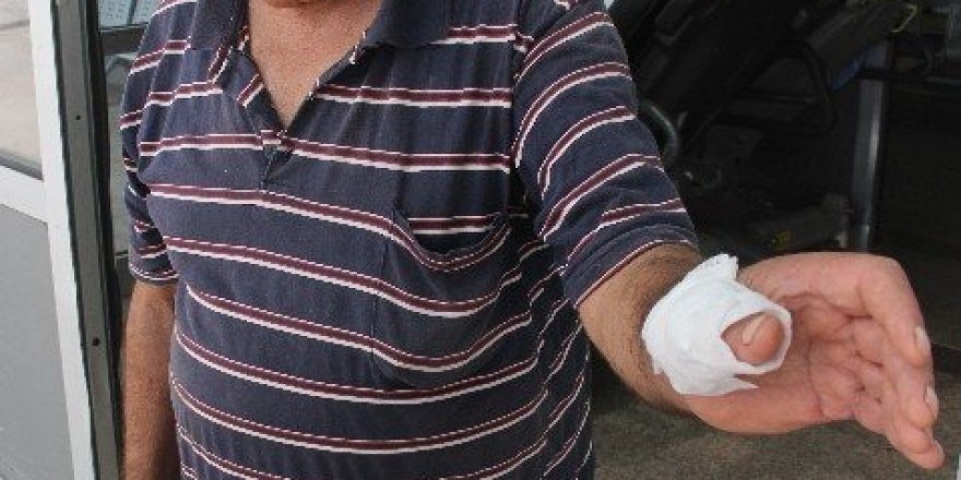 Adana’da 103 acemi kasap kendini kesti