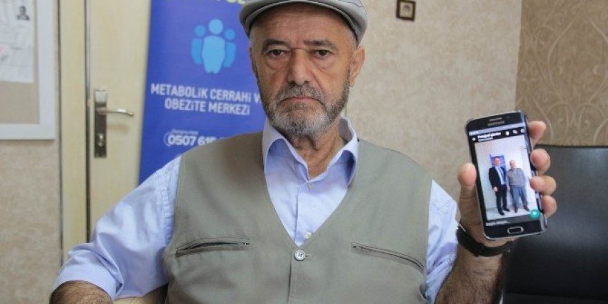 Tüp mide ameliyatı ile 49 kilo verdi