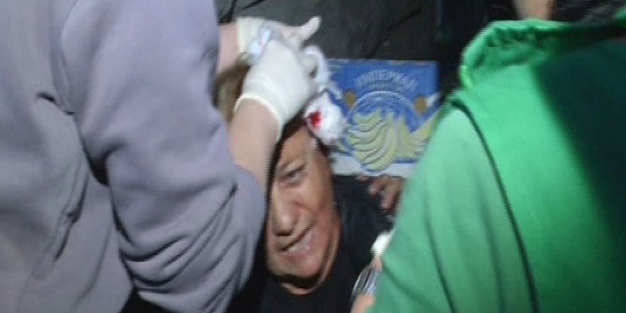 Muhalif milletvekilinin aracında patlama