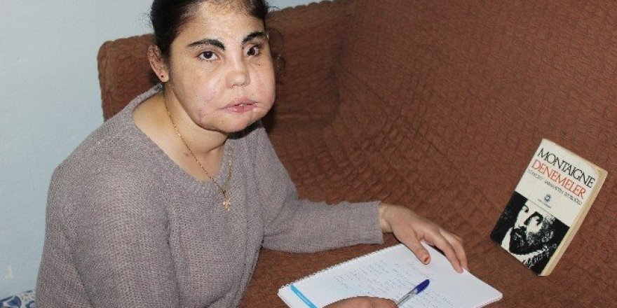 Türkiye’nin yüz nakli yapılan ilk kadını hayatını kaybetti