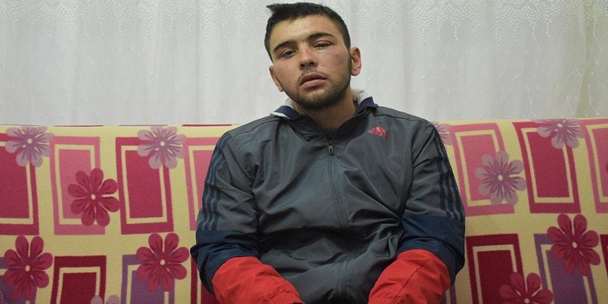 'Bir gözüm değil iki gözüm vatana feda olsun'