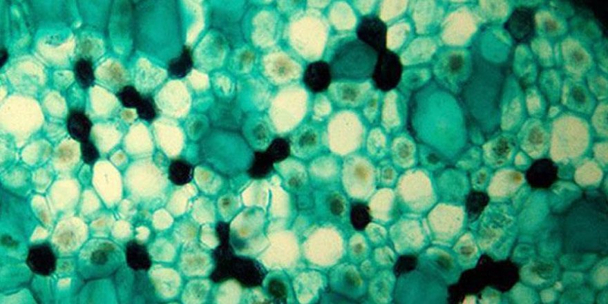 Yaşlanmayla ilgili protein keşfedildi