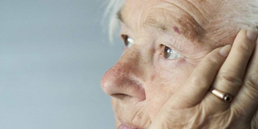 Alzheimer hastalarına ’akupunktur’