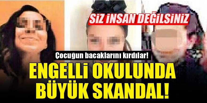Engelli okulunda büyük skandal! Çocuğun bacaklarını kırdılar