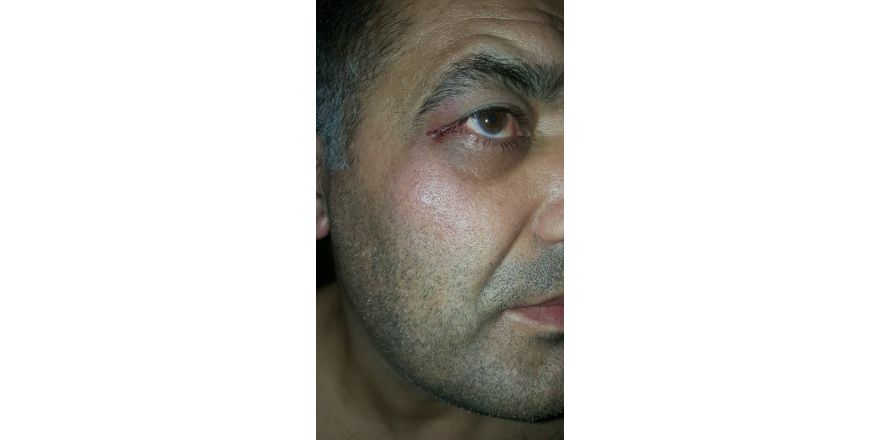 SP Kuşadası İlçe Başkanı afiş arbedesinde yaralandı
