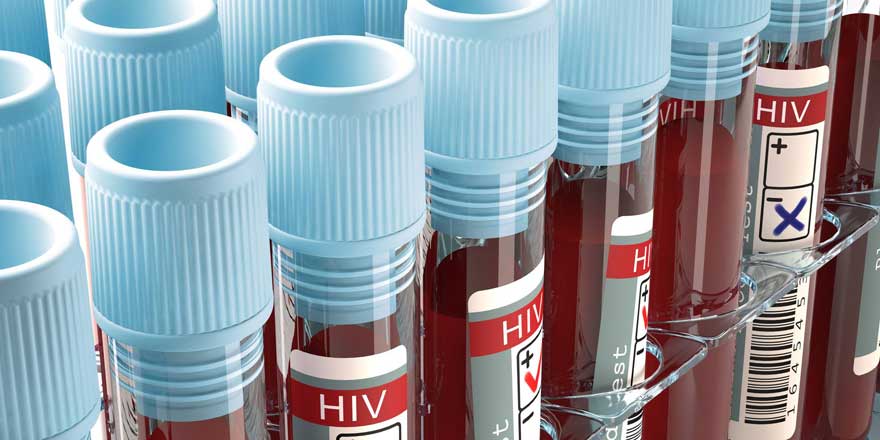 Her 4 AIDS’liden 3’ünün haberi yok