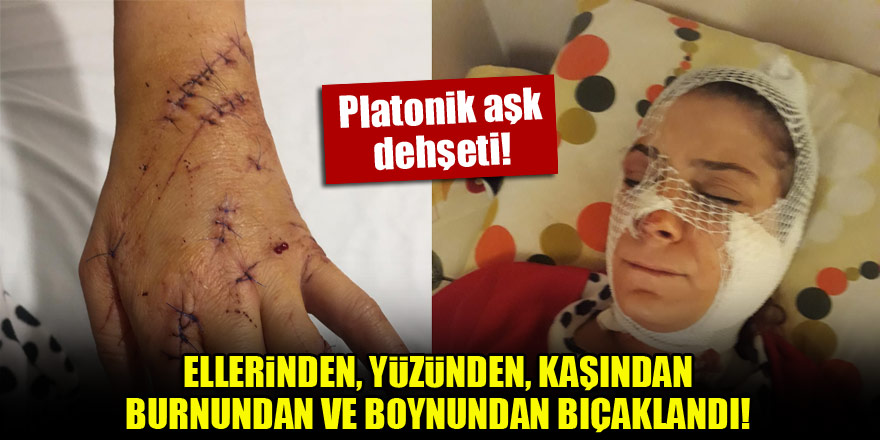 Platonik aşk dehşeti! Ellerinden, yüzünden, kaşından, burnundan ve boynundan bıçaklandı