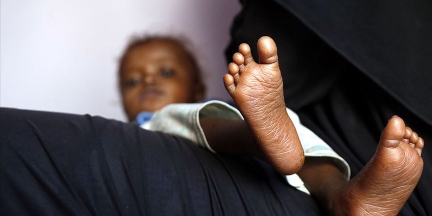 'Yemen'de 0-5 yaş arası 400 bin çocuğun acil yardıma ihtiyacı var'