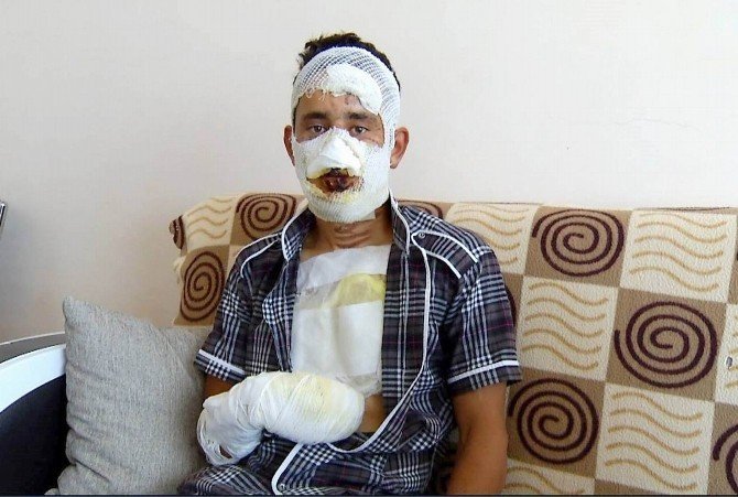Şok iddia! Konya'da askerin üzerine kolonya döküp...