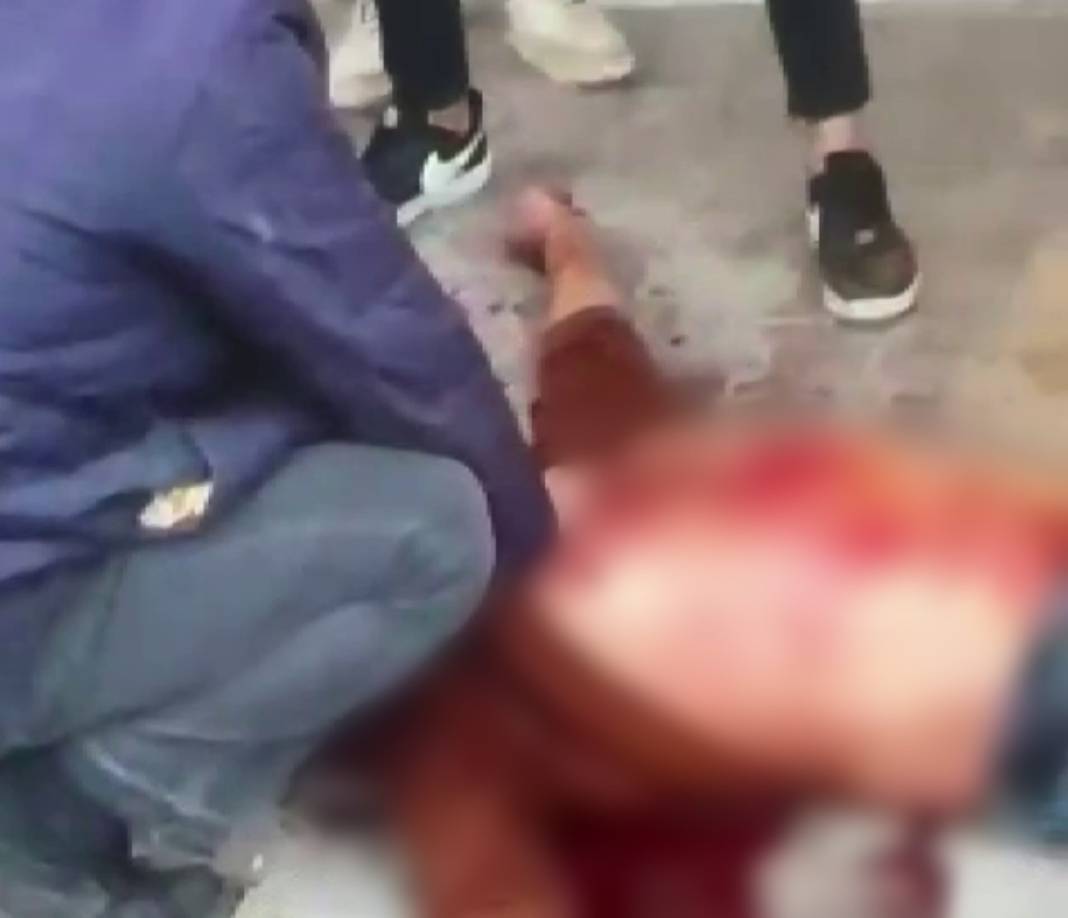 Çocukların kavgasına aileler karıştı: 1 ölü, 2 yaralı 6