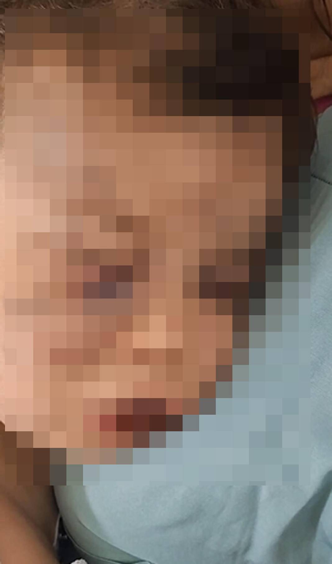 2 yaşındaki çocuk yoğun bakımda, anne ile sevgilisi gözaltında 4