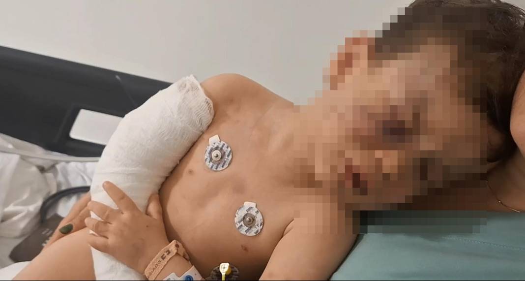 2 yaşındaki çocuk yoğun bakımda, anne ile sevgilisi gözaltında 5