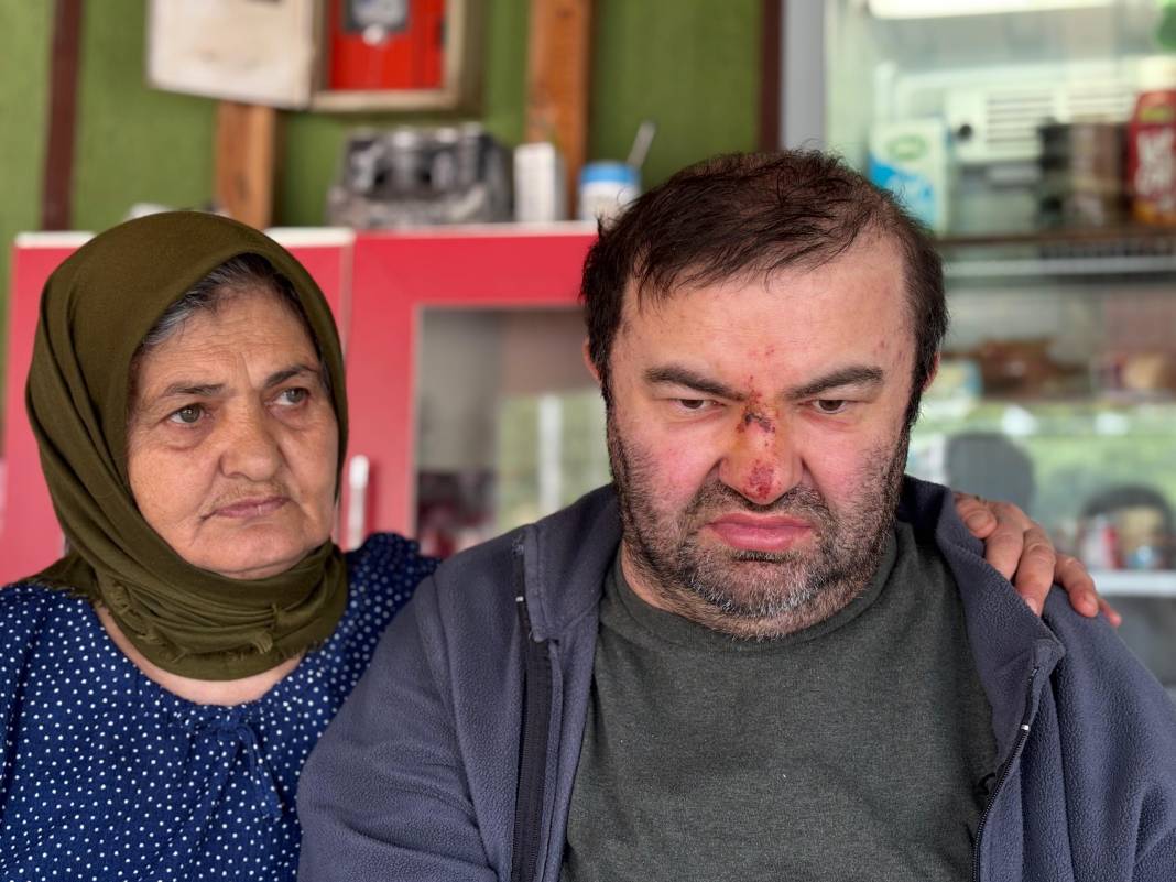 Yüzde 90 engelli vatandaşı acımasızca darp etti! 'Konuşamıyor, yemek istemeye gitmiş' 1