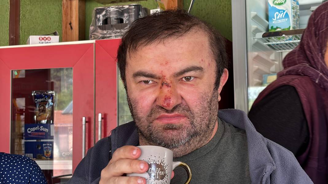 Yüzde 90 engelli vatandaşı acımasızca darp etti! 'Konuşamıyor, yemek istemeye gitmiş' 2