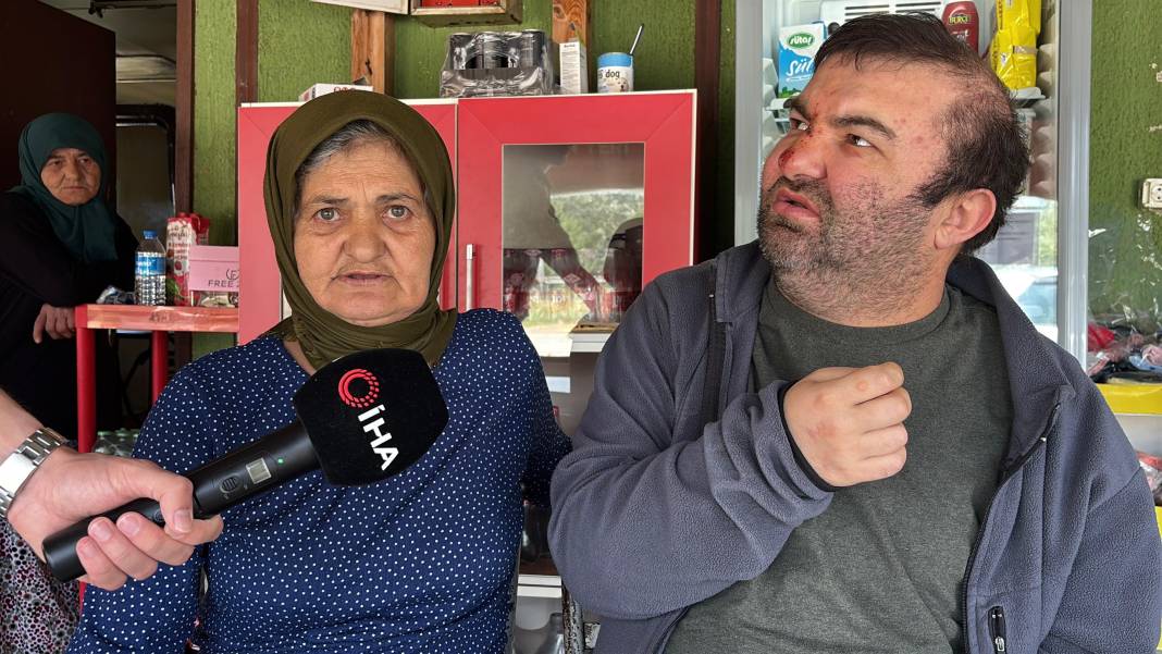 Yüzde 90 engelli vatandaşı acımasızca darp etti! 'Konuşamıyor, yemek istemeye gitmiş' 5