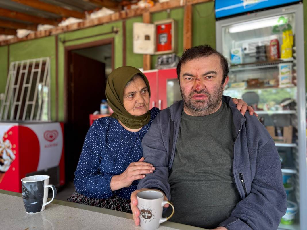 Yüzde 90 engelli vatandaşı acımasızca darp etti! 'Konuşamıyor, yemek istemeye gitmiş' 6