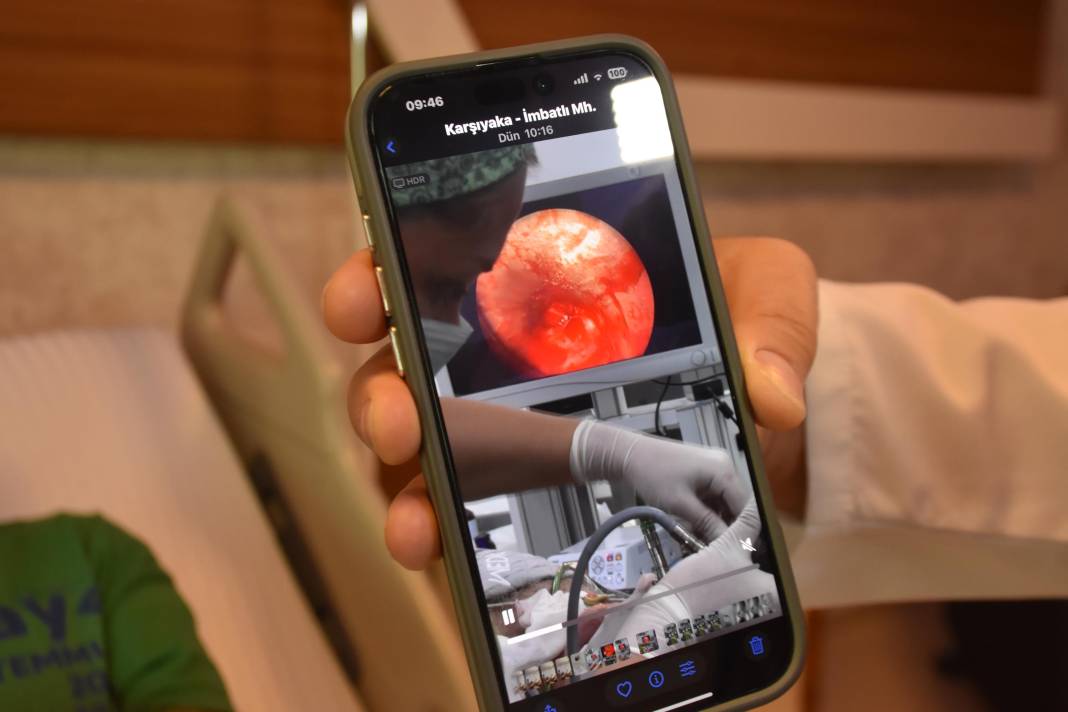 Öksürük ve balgam şikayetiyle hastanede akciğerinden diş implantı çıktı 8