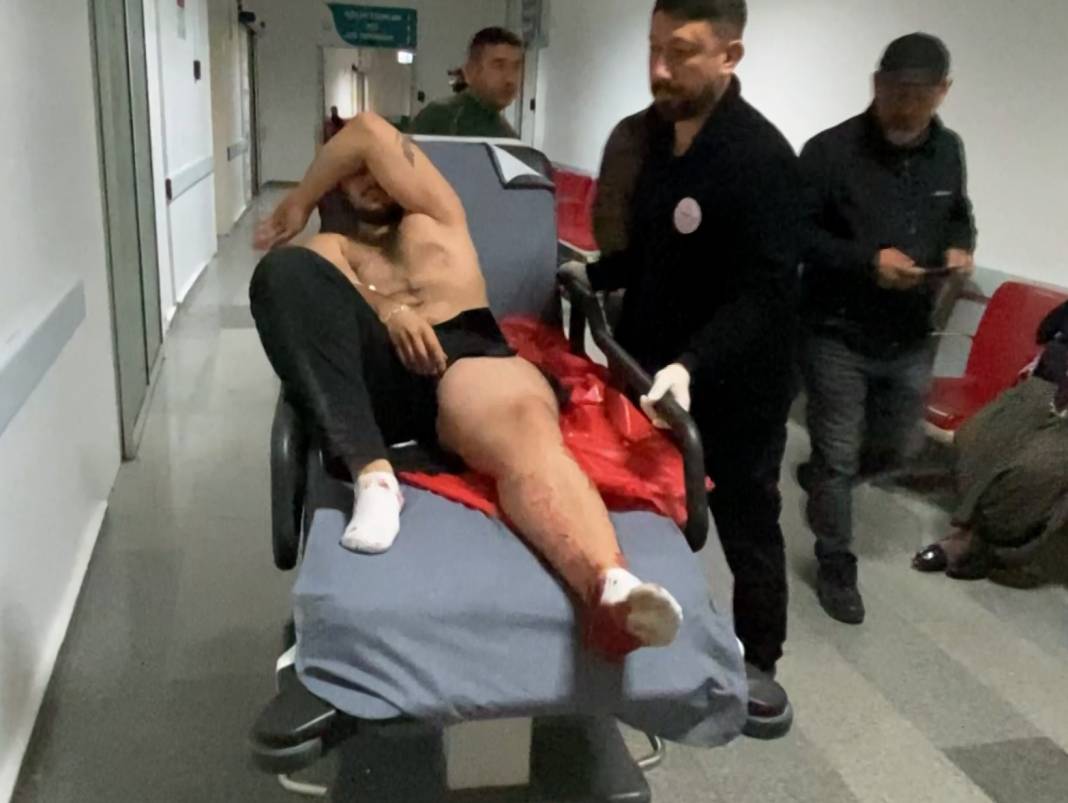 Aksaray’da ekmek kavgası kanlı bitti! 4