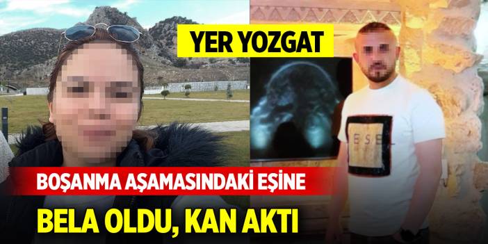 Yer Yozgat... Boşanma aşamasındaki eşine bela oldu, kan aktı