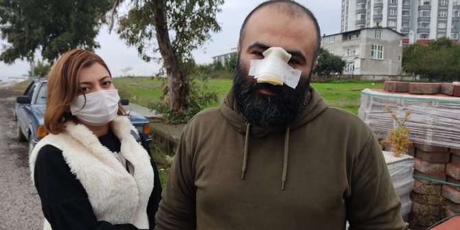 Tasmasız dolaştırılan pitbull, iş insanının burnunu kopardı