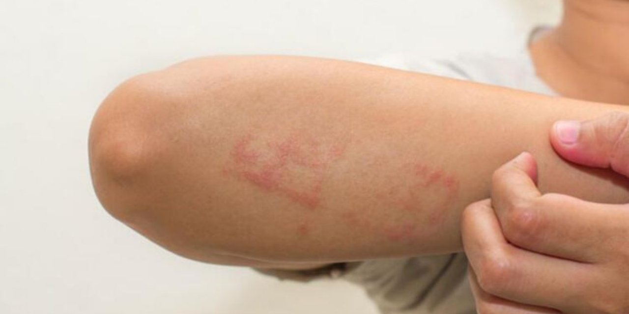 Uzmanı uyardı: Glüten alerjisi bu yaşlarda daha sık görülüyor