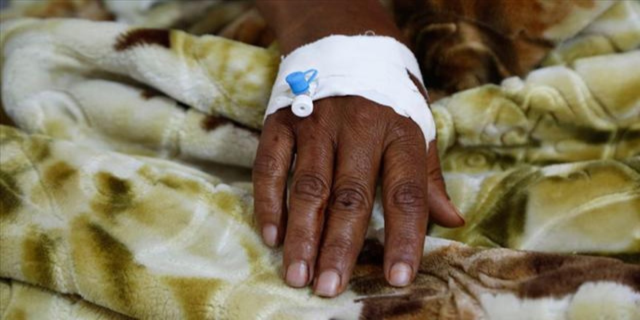 Kamerun’daki kolera salgınında 426 kişi öldü