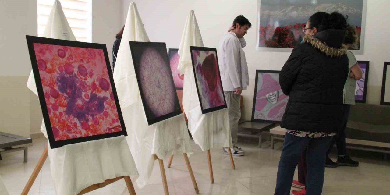 Konya Numune Hastanesi Tıbbi Patoloji Uzmanı hastalıklı dokuları sanat eserine dönüştürdü