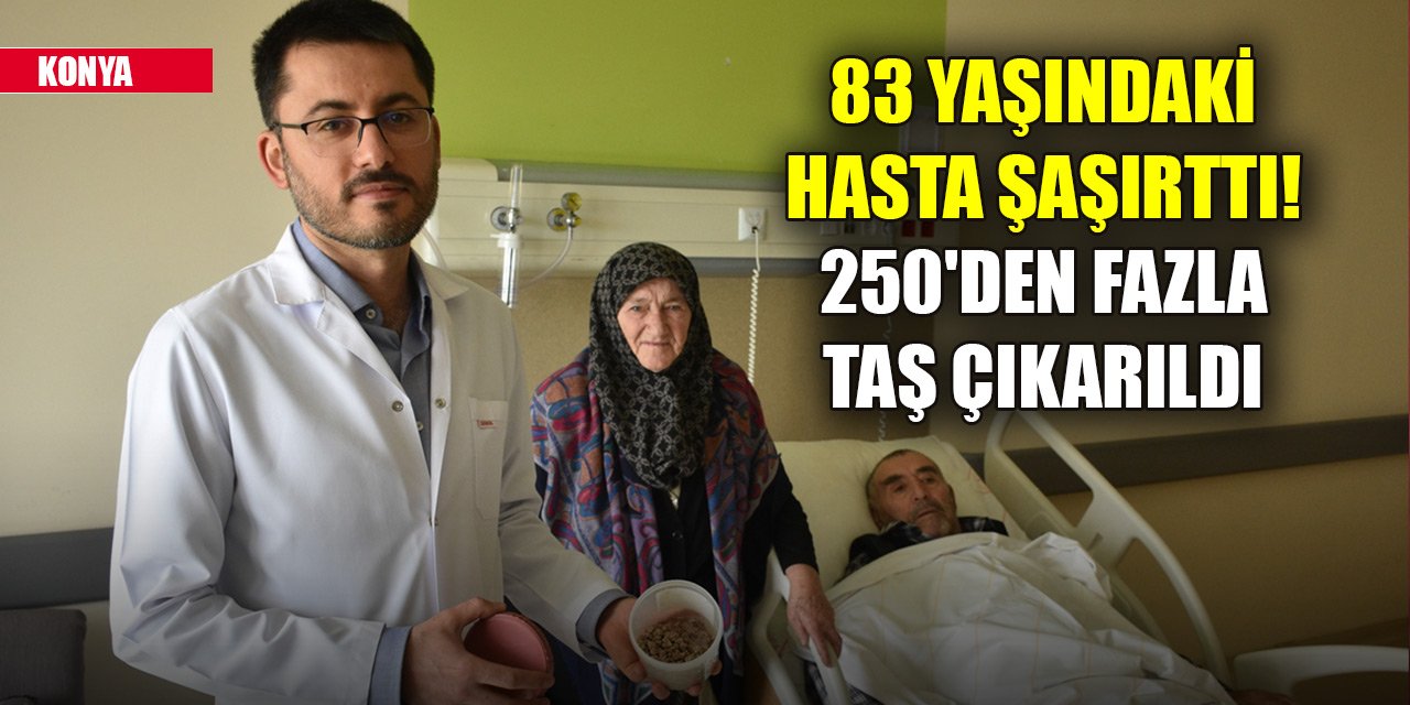 Konya Şehir Hastanesi'nde 83 yaşındaki hasta şaşırttı! 250'den fazla taş çıkarıldı