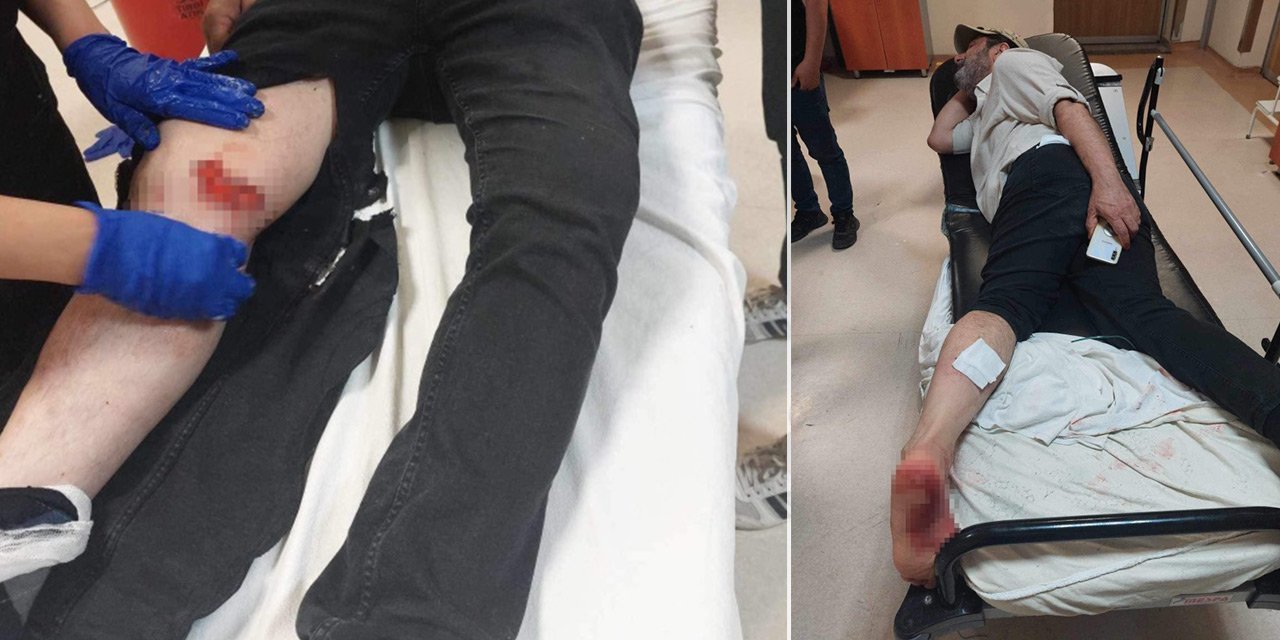 Ankara'da başıboş sokak köpekleri tehlike saçtı,  2 yaralı!