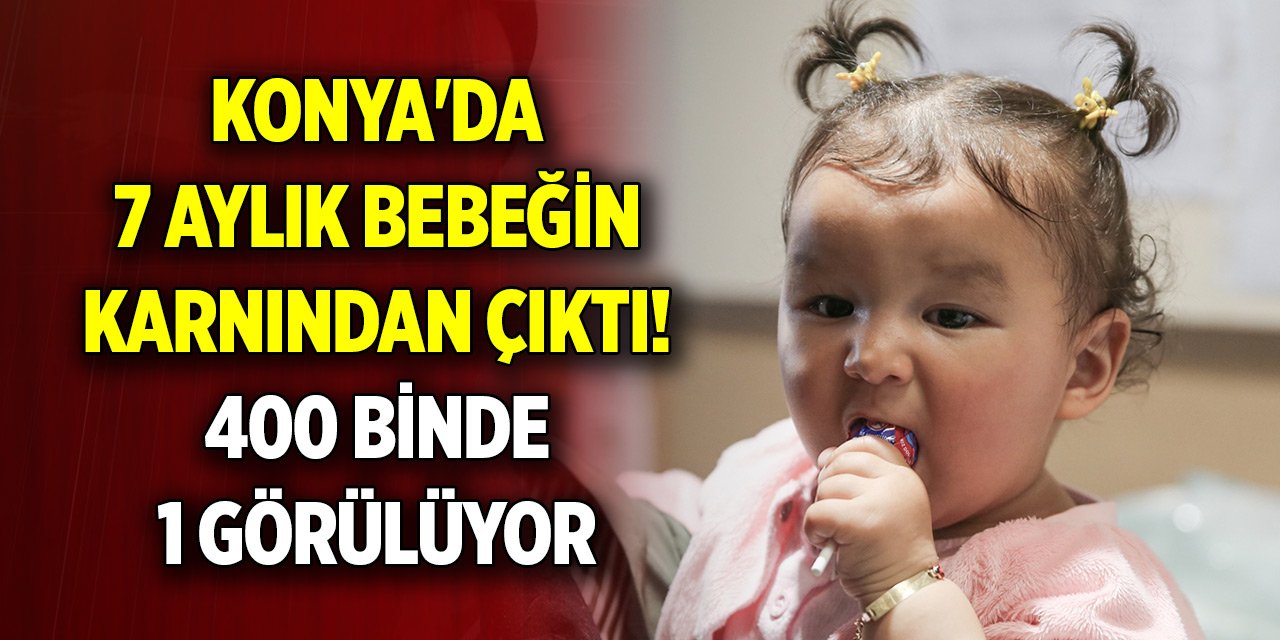 Konya'da 7 aylık bebeğin karnından çıktı! 400 binde 1 görülüyor