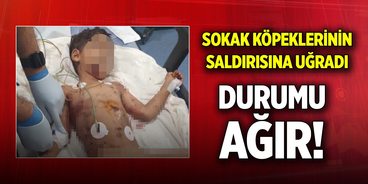 Adana'da 5 yaşındaki çocuk sokak köpeklerinin saldırısına uğradı! Durumu ağır...