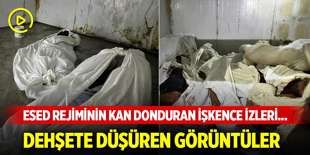 Esed rejiminin kan donduran işkence izleri... Dehşete düşüren görüntüler ortaya çıktı