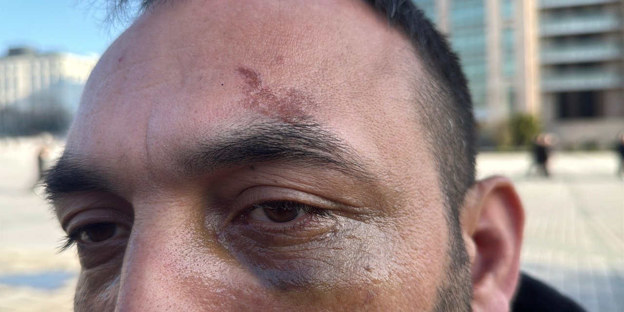 Sevgilisinin evinde dehşeti yaşadı!