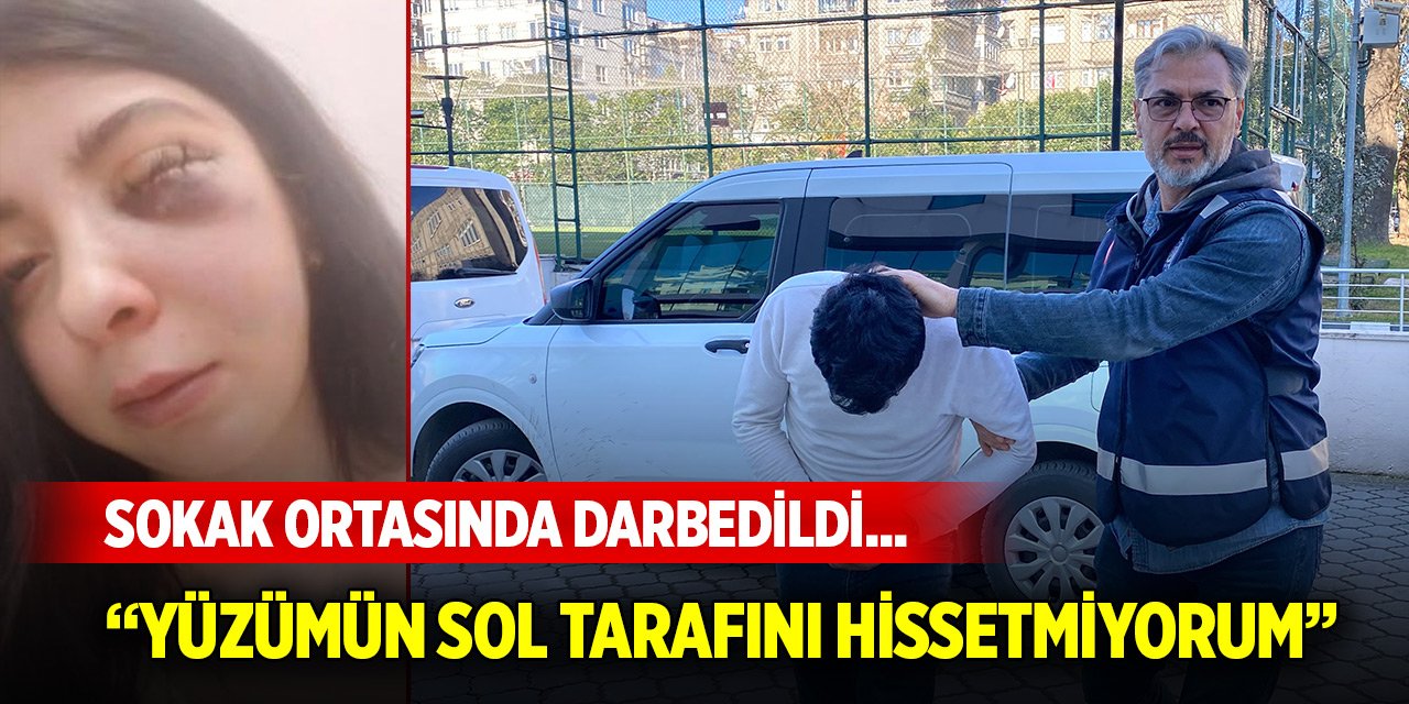 Sokak ortasında darbedildi... Artık yüzümün sol tarafını hissetmiyorum