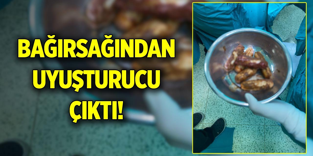 Bağırsağından uyuşturucu çıktı!