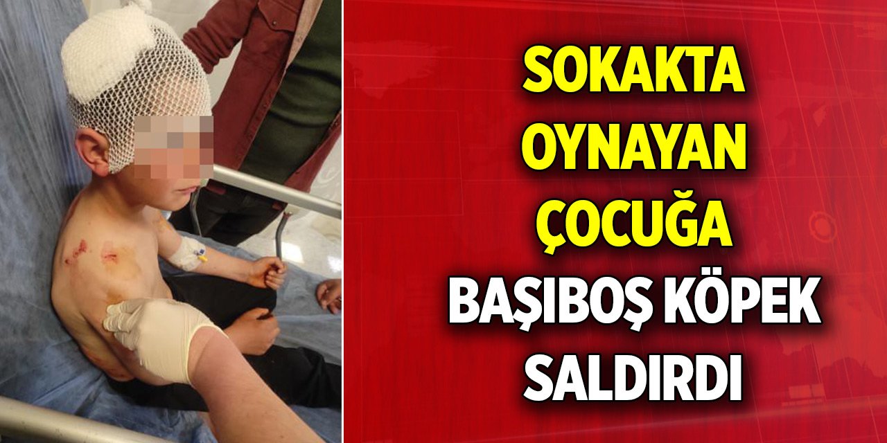 Isparta’da sokakta oynayan çocuğa başıboş köpek saldırdı