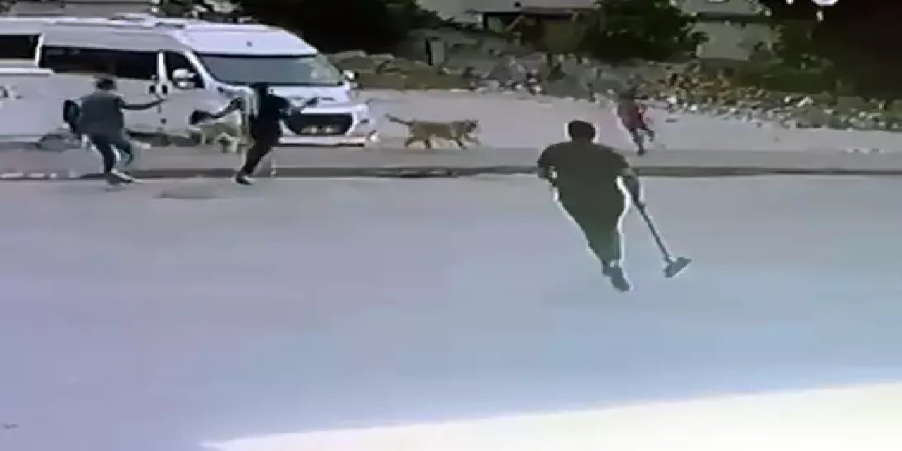 Sokak köpekleri çocuğa saldırdı