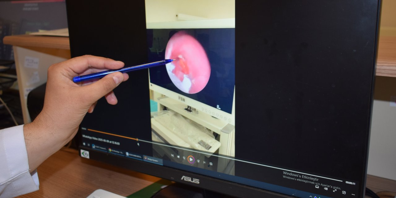 Şeker ambalajı bebeğin nefes borusuna kaçtı