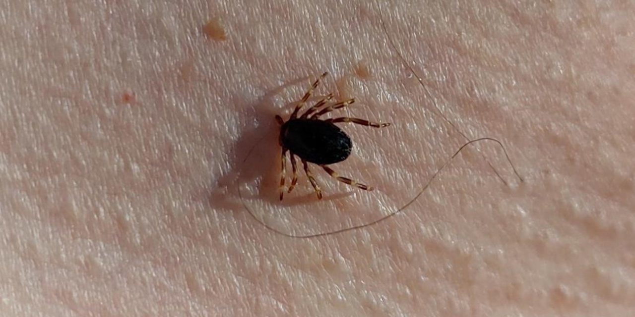 Kene kaynaklı 3 hastalığa dikkat