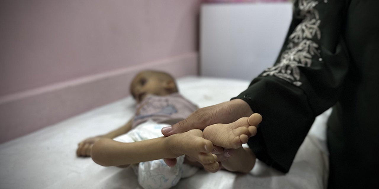 Son Dakika! Dışişlerinden Gazze’de yaşanan kıtlık durumuna ilişkin açıklama