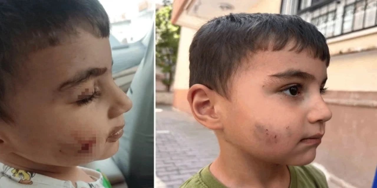 Uyurken dehşeti yaşadı