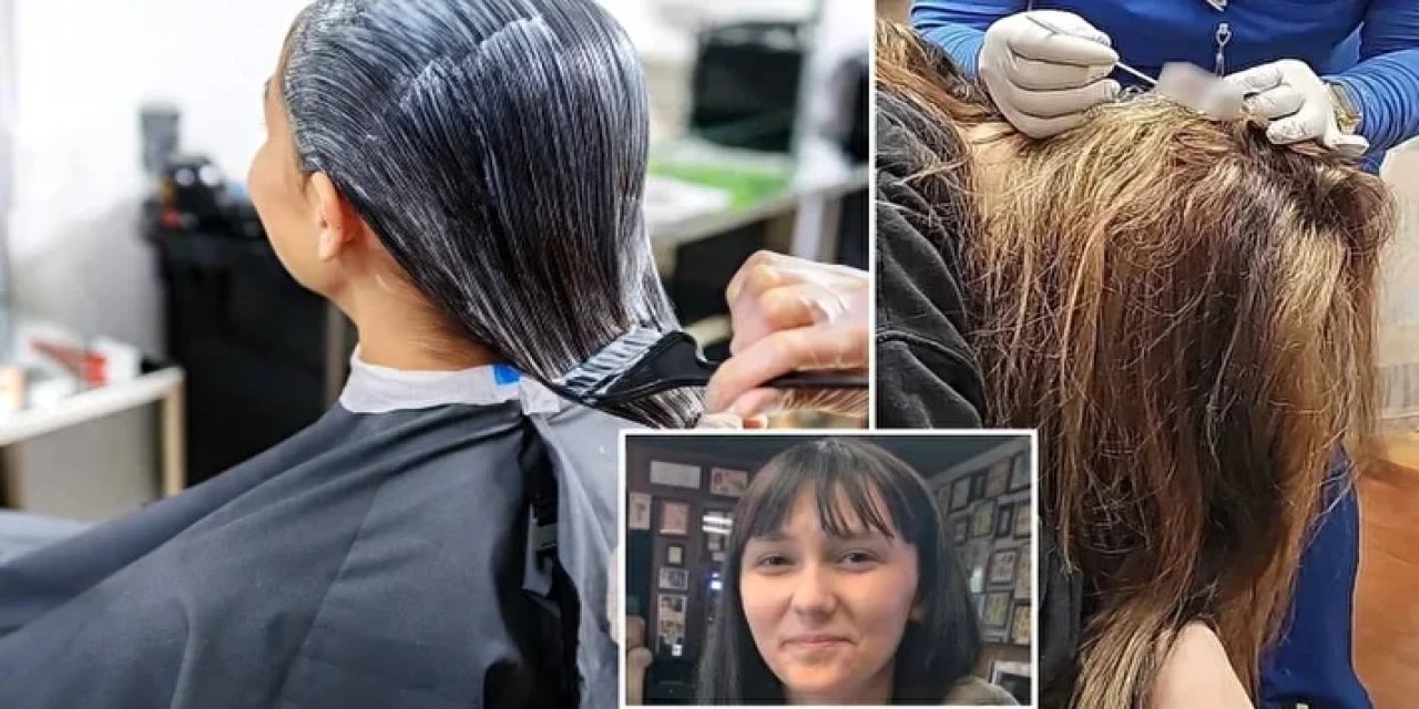 Saçını boyattı başına gelmeyen kalmadı: Genç kızın kafasında delik açıldı