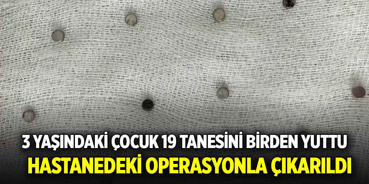3 yaşındaki çocuk 19 tanesini birden yuttu: Hastanedeki operasyonla çıkarıldı